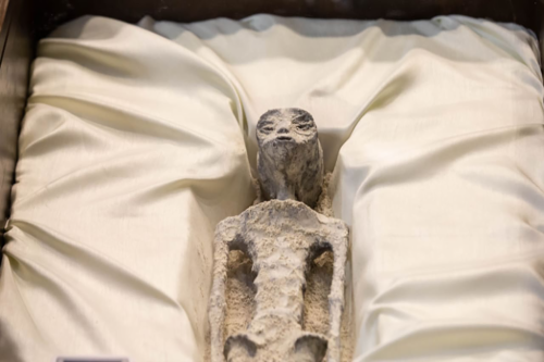 Casos en Investigación